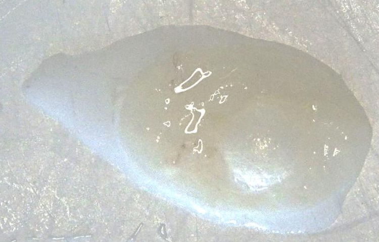 Description of the image